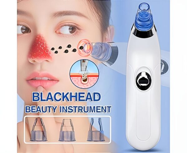 Blackhead Remover